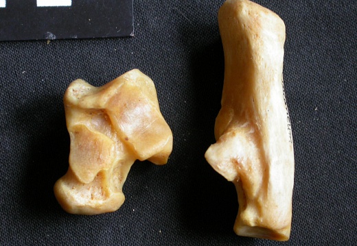 Talus and calcaneus