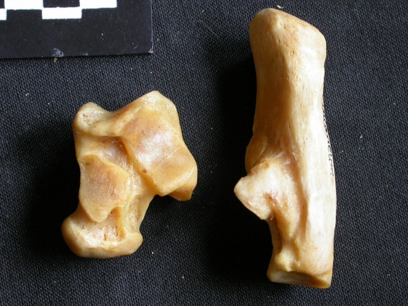 Talus and calcaneus