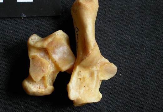 Talus and calcaneus