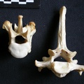 Thoracic vertebrae