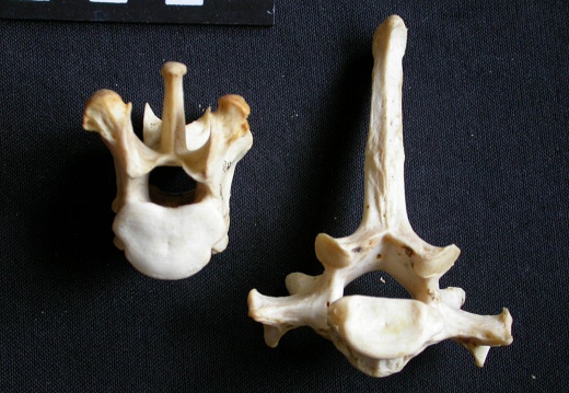 Thoracic vertebrae