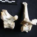 Thoracic vertebrae