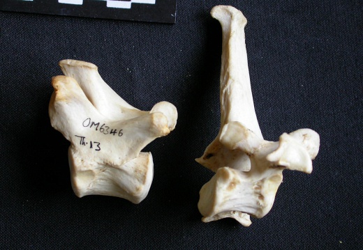 Thoracic vertebrae