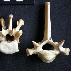 Thoracic vertebrae