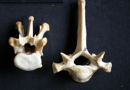 Thoracic vertebrae