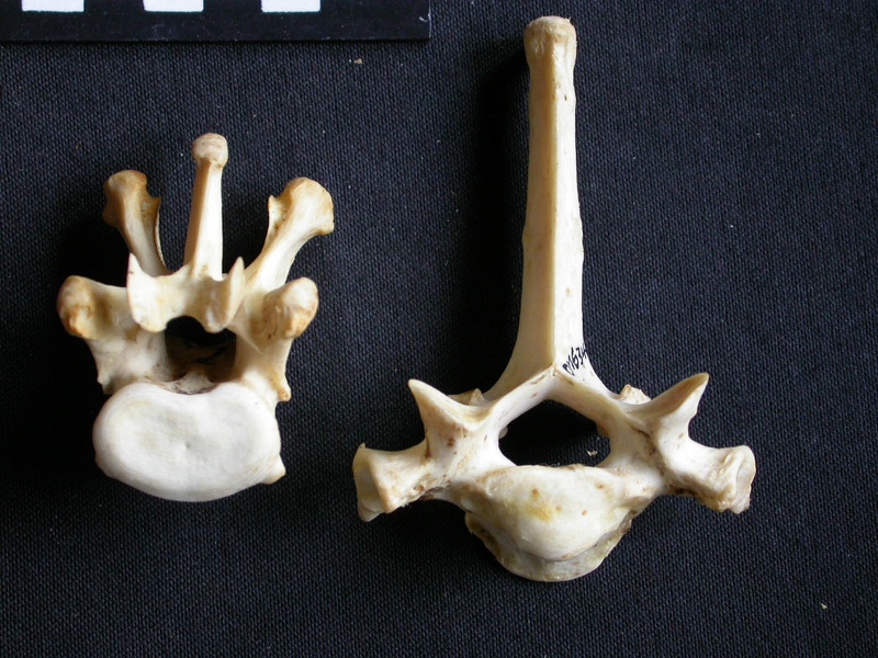 Thoracic vertebrae