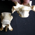 Thoracic vertebrae