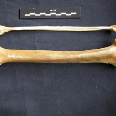 Tibia et fibula