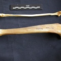 Tibia et fibula