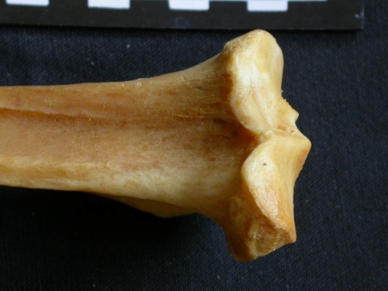  Tibia: proximale part