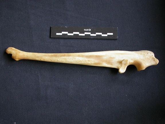 Ulna