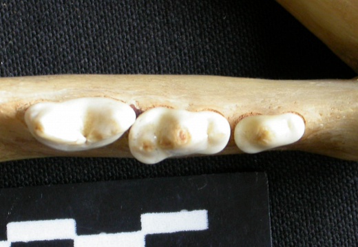 Lower teeth