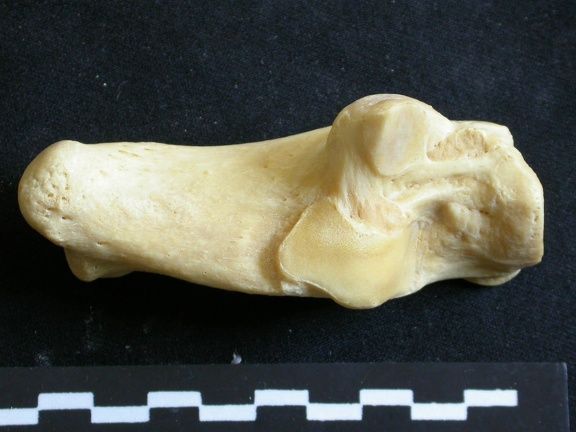 Calcaneus