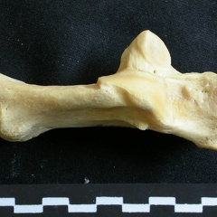 Calcaneus