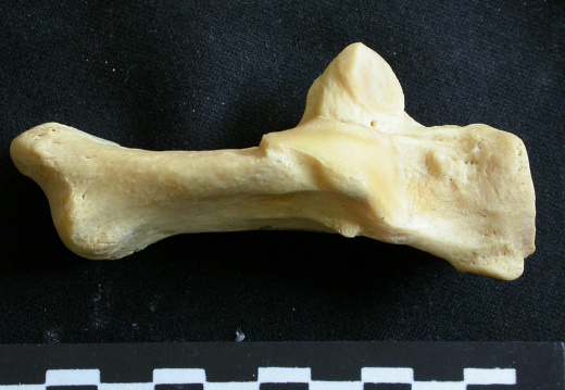 Calcaneus