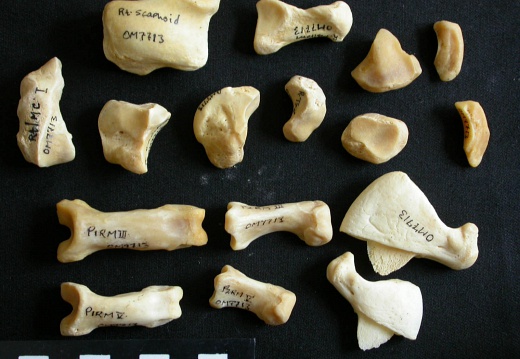 Carpus and phalanges