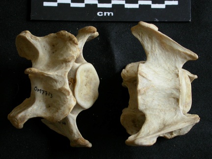 Cervical vertebrae