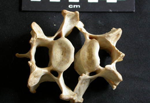 Cervical vertebrae