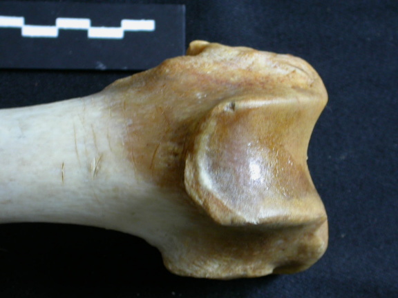 Fémur : partie distale