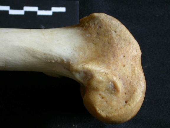 Femur: distal part