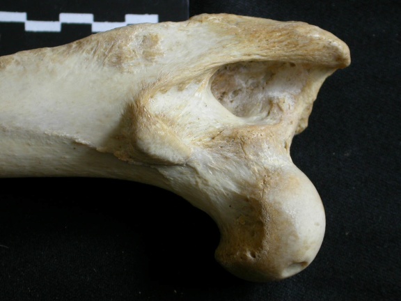 Femur: proximale part