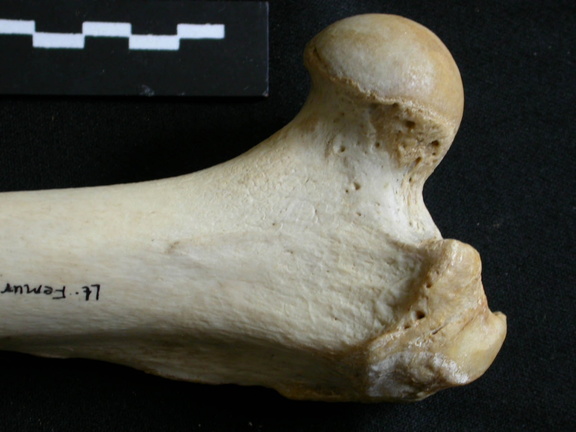 Fémur : partie proximale