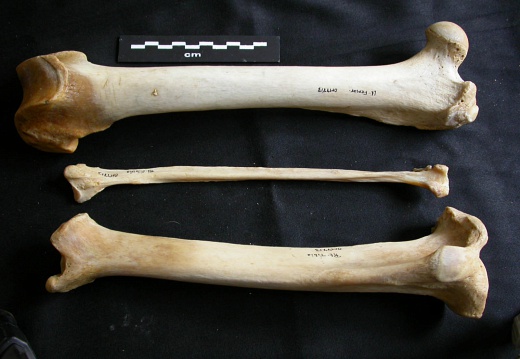  Fémur, tibia y fíbula