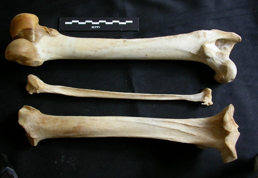  Femur, tibia and fibula