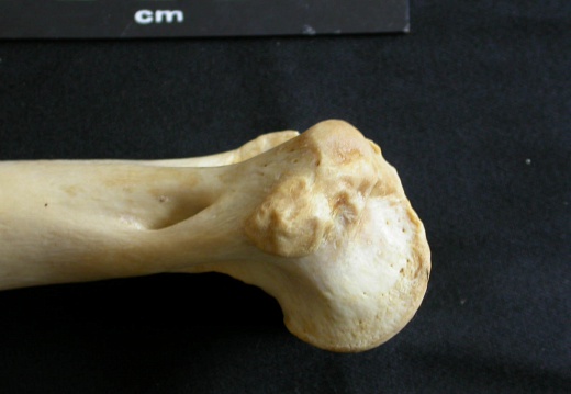 Humerus: distal part