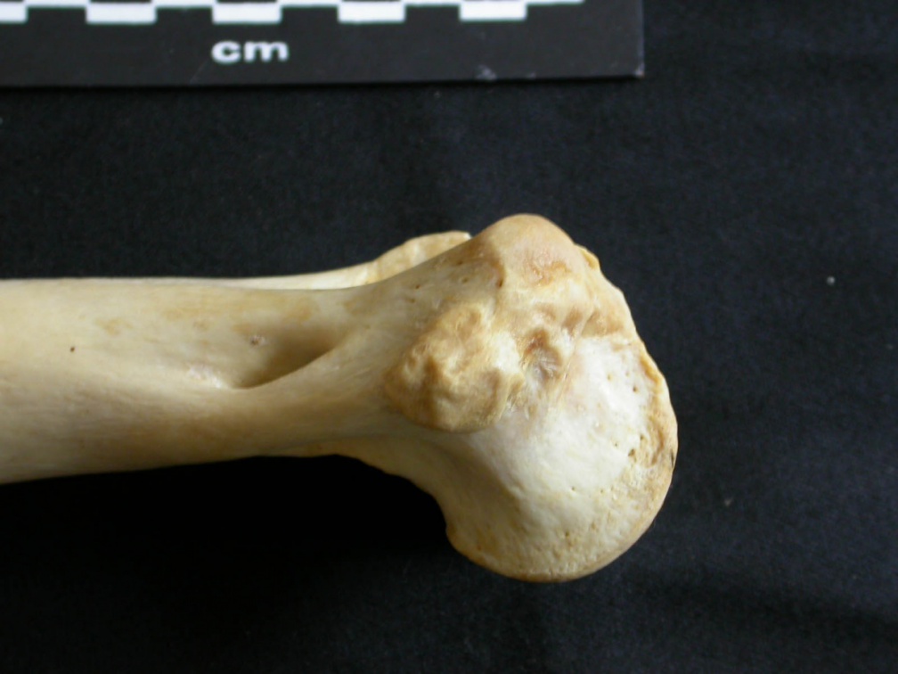 Humerus: distal part