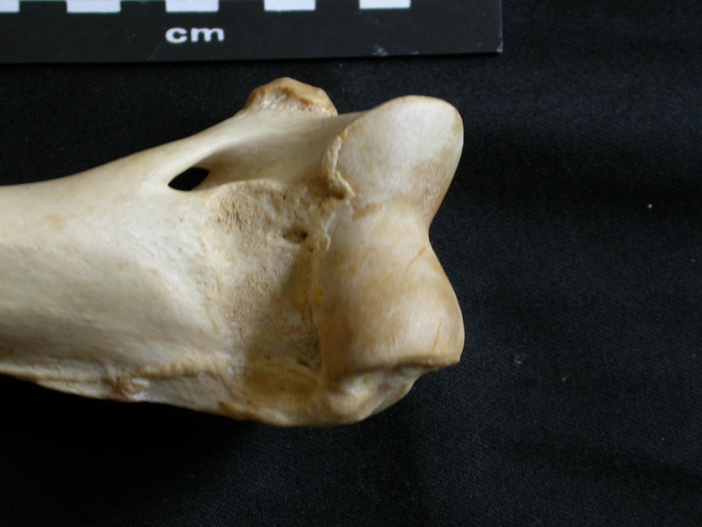 Humerus: distal part