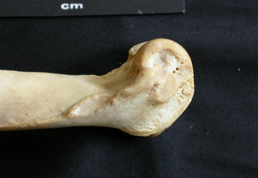 Humerus: distal part