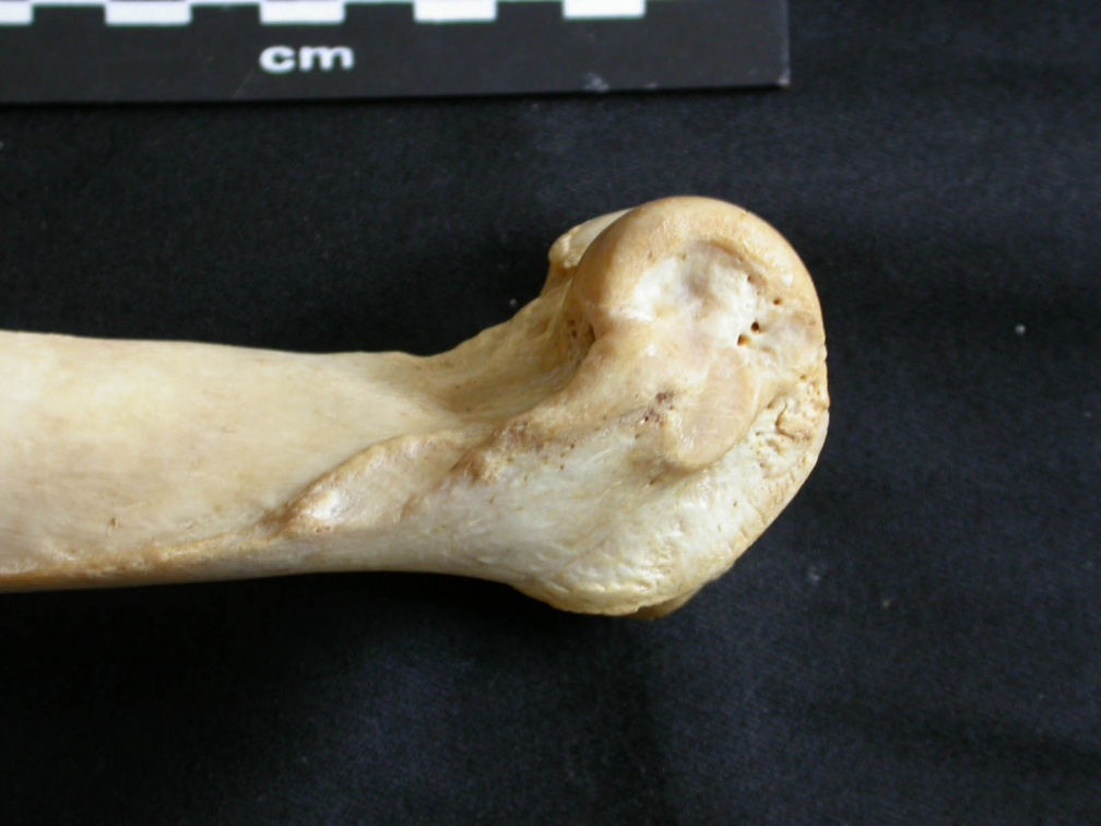Humerus: distal part