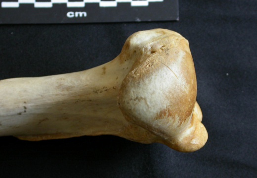 Humerus: proximale part