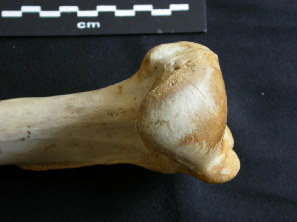 Humerus: proximale part