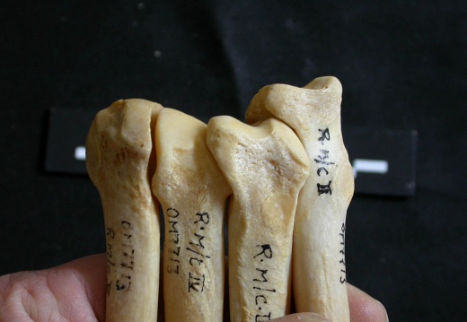 Metacarpals: proximale part