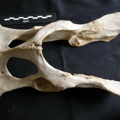 Pelvis