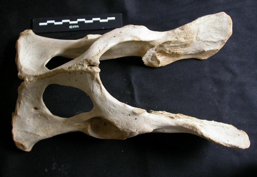 Pelvis