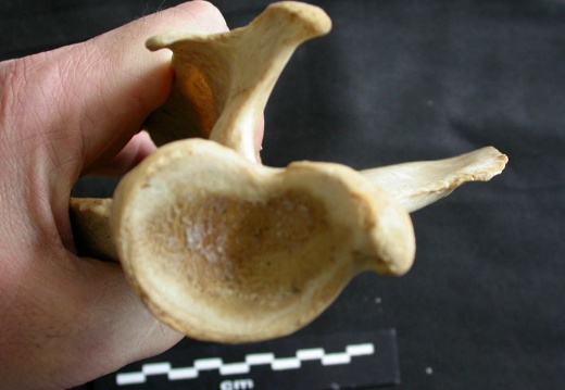 Scapula : vue ventrale