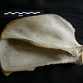 Scapula : vue latérale