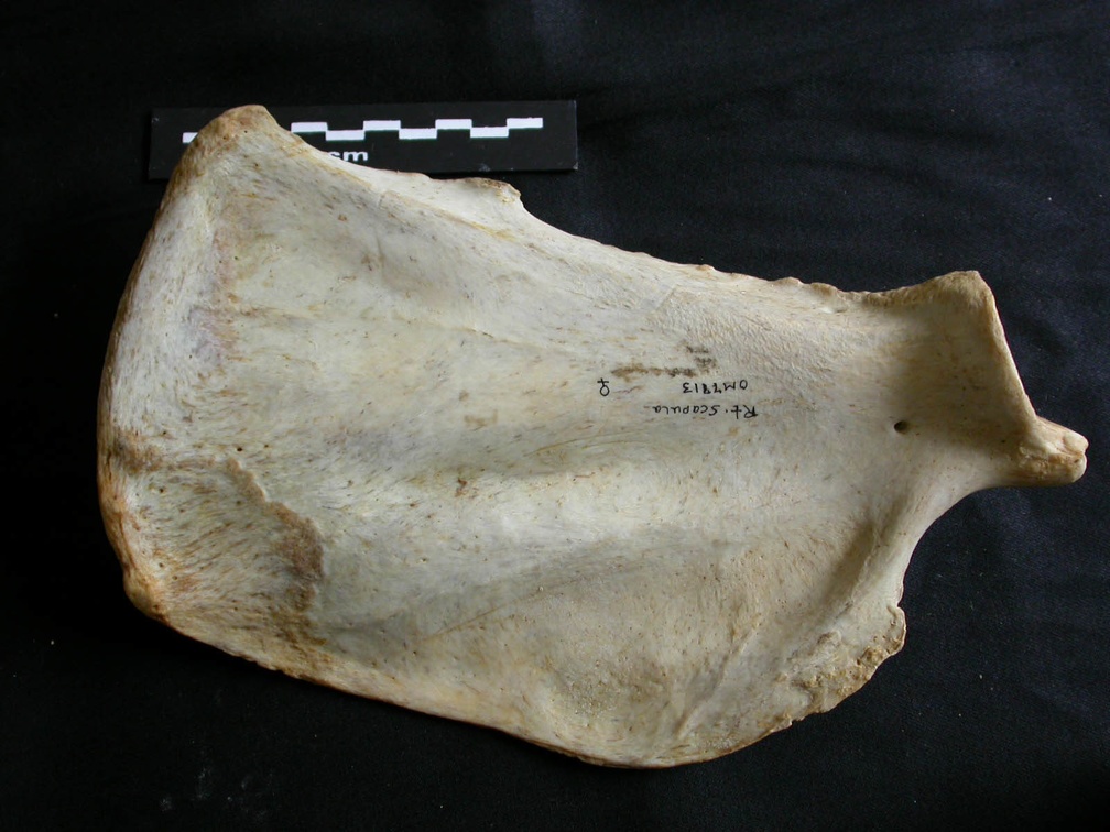 Scapula : vue médiale