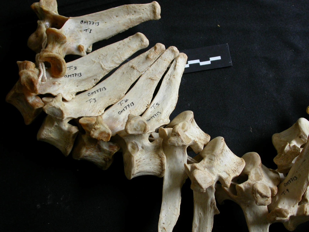 Thoracic vertebrae