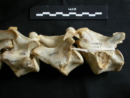 Vertèbres thoraciques