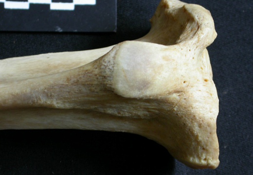  Tibia: proximale part