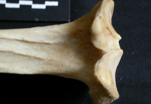  Tibia: proximale part