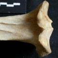  Tibia: proximale part