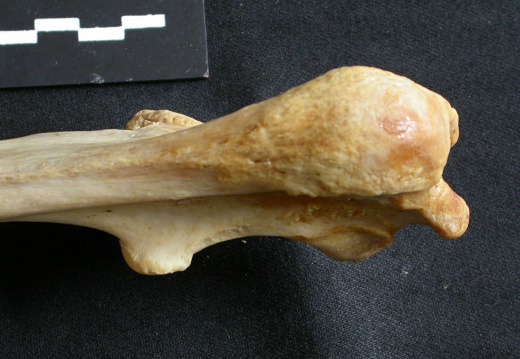  Ulna: proximale part