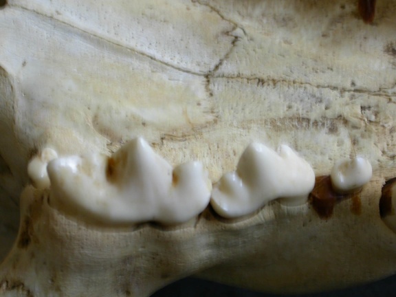 Dentition supérieure