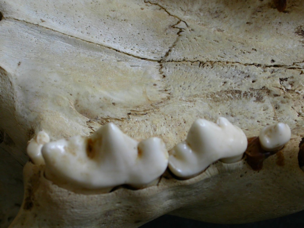 Dentition supérieure