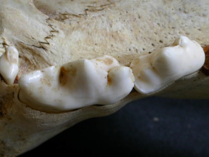 Dentition supérieure